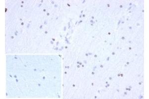 Recombinant OLIG2 抗体  (AA 200-300)