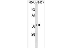 Western blot analysis in MDA-MB453 cell line lysates (35ug/lane). (MEOX2 Antikörper  (AA 164-192))
