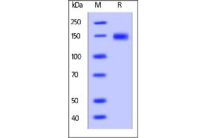 Cynomolgus LDL R, His Tag on  under reducing (R) condition. (LDLR Protein (AA 22-788) (His tag))