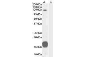 Western Blotting (WB) image for anti-rho GTPase Activating Protein 26 (ARHGAP26) (C-Term) antibody (ABIN2465789) (GRAF Antikörper  (C-Term))