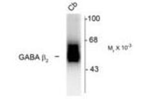 Image no. 1 for anti-gamma-aminobutyric Acid (GABA) A Receptor, beta 2 (GABRB2) (Cytoplasmic Domain) antibody (ABIN228403) (GABRB2 Antikörper  (Cytoplasmic Domain))