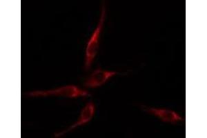 ABIN6275113 staining HepG2 cells by IF/ICC. (Epsin 2 Antikörper  (Internal Region))