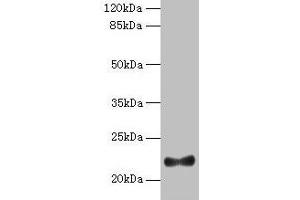 Western blot All lanes: IFNAG antibody at 2 μg/mL + HL60 whole cell lysate Secondary Goat polyclonal to rabbit IgG at 1/10000 dilution Predicted band size: 22 kDa Observed band size: 22 kDa (IFNA5 Antikörper  (AA 24-189))