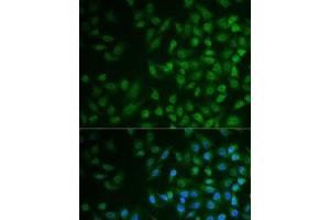 Immunofluorescence analysis of MCF7 cells using MPP2 Polyclonal Antibody (MPP2 Antikörper)