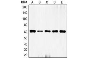 Western blot analysis of c-FOS expression in HeLa (A), NIH3T3 (B), mouse brain (C), rat kidney (D), rat brain (E) whole cell lysates.