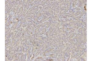 Immunohistochemistry (IHC) image for anti-DKK3 antibody (ABIN1872281) (DKK3 Antikörper)