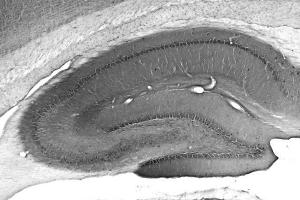 Adult rat hippocampus immunohistochemistry.