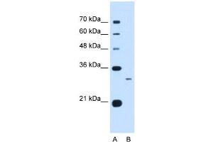 C1QB antibody used at 0. (C1QB Antikörper  (C-Term))