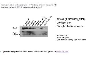 Western Blotting (WB) image for anti-Cyclin A2 (CCNA2) (C-Term) antibody (ABIN2779289) (Cyclin A Antikörper  (C-Term))