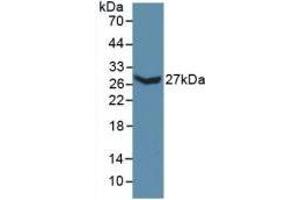 Detection of Recombinant COL3a1, Mouse using Polyclonal Antibody to Collagen Type III Alpha 1 (COL3a1) (COL3A1 Antikörper  (AA 434-643))