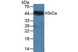 Detection of CTBP2 in Porcine Heart Tissue using Polyclonal Antibody to C-Terminal Binding Protein 2 (CTBP2) (CTBP2 Antikörper  (AA 1-252))