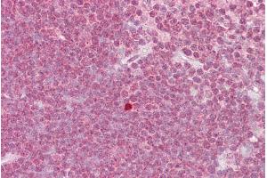 Immunohistochemistry with Thymus tissue at an antibody concentration of 5µg/ml using anti-ZBTB7A antibody (ARP39211_P050) (ZBTB7A Antikörper  (N-Term))