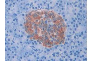Immunohistochemistry (IHC) image for anti-Slit Homolog 1 (SLIT1) (AA 647-835) antibody (ABIN7438364)