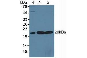 Figure. (SKP1 Antikörper  (AA 1-163))