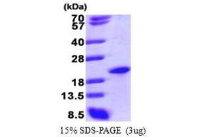 SDS-PAGE (SDS) image for Sin3A-Associated Protein, 18kDa (SAP18) (AA 20-172) protein (His tag) (ABIN666775) (SAP18 Protein (AA 20-172) (His tag))