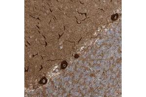 Immunohistochemical staining of human cerebellum with ECM2 polyclonal antibody  shows strong cytoplasmic and nucleolar positivity in purkinje cells at 1:200-1:500 dilution. (ECM2 Antikörper)