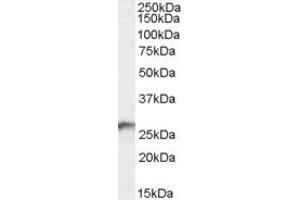Western Blotting (WB) image for anti-3-hydroxybutyrate Dehydrogenase, Type 2 (BDH2) (Internal Region) antibody (ABIN238652)
