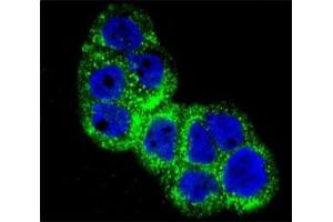 Immunofluorescence (IF) image for anti-Insulin-Like Growth Factor 1 Receptor (IGF1R) (AA 51-77) antibody (ABIN3031345)