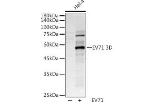 Western blot analysis of extracts of various cell lines, using (ABIN6127666, ABIN6140342, ABIN6140343 and ABIN6224720) at 1:1000 dilution. (EV71 Antikörper)
