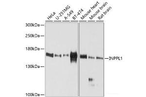 Western blot analysis of extracts of various cell lines using INPPL1 Polyclonal Antibody at dilution of 1:1000. (INPPL1 Antikörper)