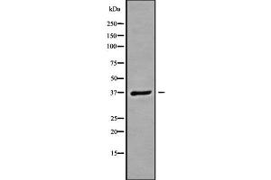 Western Blotting (WB) image for anti-Guanine Nucleotide Binding Protein (G Protein), beta Polypeptide 3 (GNB3) (C-Term) antibody (ABIN6262015)