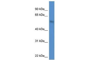 WB Suggested Anti-MKNK1 AntibodyTitration: 1. (MKNK1 Antikörper  (N-Term))