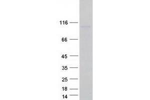 Validation with Western Blot (ANKS6 Protein (Myc-DYKDDDDK Tag))