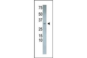 RCAN3 Antikörper  (N-Term)