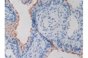 IHC-P analysis of Mouse Lung Tissue, with DAB staining. (Secretin Antikörper  (AA 26-133))