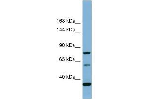 Host:  Rabbit  Target Name:  MYO16  Sample Type:  COLO205 Whole cell lysates  Antibody Dilution:  1. (Myosin XVI Antikörper  (Middle Region))