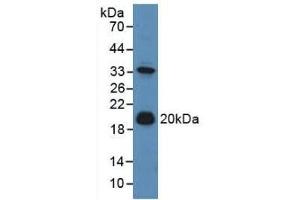 Detection of ADM in Mouse Liver Tissue using Polyclonal Antibody to Adrenomedullin (ADM) (Adrenomedullin Antikörper  (AA 24-171))