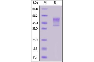 SDS-PAGE (SDS) image for Syndecan 1 (SDC1) (AA 23-254) (Active) protein (His tag) (ABIN7013604)