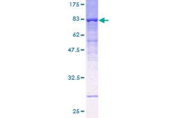 ATP6V1B1 Protein (AA 1-513) (GST tag)