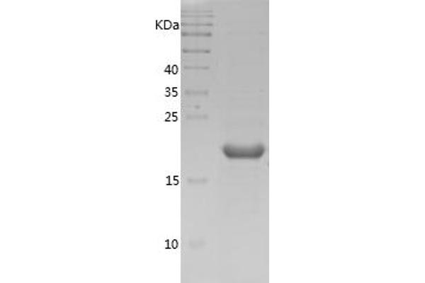 Cofilin Protein (AA 2-166) (His tag)