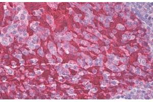 Image no. 1 for anti-Stratifin (SFN) (AA 120-170) antibody (ABIN1490876) (14-3-3 sigma/SFN Antikörper  (AA 120-170))