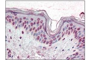 Immunohistochemistry (IHC) image for anti-X-Box Binding Protein 1 (XBP1) (AA 2-160) antibody (ABIN492538) (XBP1 Antikörper  (AA 2-160))