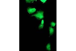 Anti-FBXO21 mouse monoclonal antibody (ABIN2455368) immunofluorescent staining of COS7 cells transiently transfected by pCMV6-ENTRY FBXO21 (RC223095). (FBXO21 Antikörper)