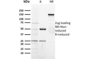 SDS-PAGE AnalysisPurified CD5-Monospecific Mouse Monoclonal Antibody (CD5/2418). (CD5 Antikörper  (AA 269-366))