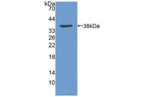 Detection of Recombinant VLDLR, Human using Polyclonal Antibody to Very Low Density Lipoprotein Receptor (VLDLR) (VLDLR Antikörper  (AA 418-722))