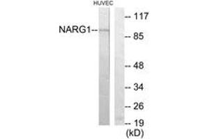 Western blot analysis of extracts from HuvEc cells, using NARG1 Antibody. (NAA15 Antikörper  (AA 221-270))