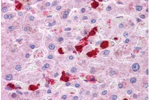 Immunohistochemistry (Formalin-fixed Paraffin-embedded Sections) (IHC (fp)) image for anti-Leucine Rich Repeat Containing 8 Family, Member B (LRRC8B) (AA 542-591) antibody (ABIN6745738)