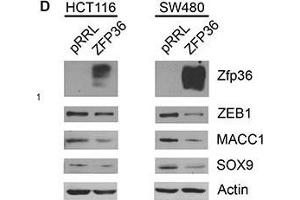 Validation of three novel ZFP36 target genes involved in EMT(Panel A) Boxplot of Log 2 expression values of MACC1, SOX9 and ZEB1 in 23 normal colon mucosa (Normal), 30 primary colon carcinoma (CRC) and 27 liver metastases (Mts) samples.