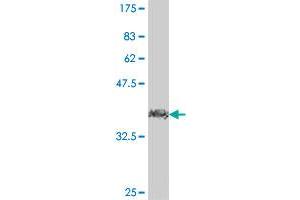 Western Blot detection against Immunogen (38. (FBXL17 Antikörper  (AA 194-303))