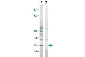 Western blot analysis of Lane 1: Untreated K562 cell lysates, Lane 2: Synthesized peptide treated K562 cell lysates reacted with BIK (phospho T33) polyclonal antibody  at 1:500-1:3000 dilution. (BIK Antikörper  (pThr33))