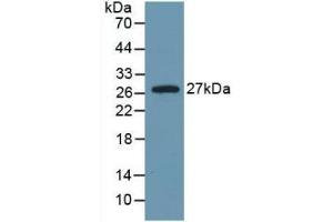 Detection of Recombinant IL6, Rat using Monoclonal Antibody to Interleukin 6 (IL6) (IL-6 Antikörper  (AA 25-211))