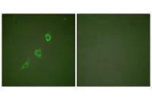 Immunofluorescence analysis of NIH/3T3 cells, using HSP10 antibody. (HSPE1 Antikörper)