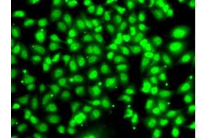 Immunofluorescence analysis of U20S cell using COPS2 antibody. (COPS2 Antikörper)