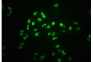 Immunofluorescence staining of HepG2 cells(treated with 100 mM Calyculin A for 30 min) with ABIN7127753 at 1:66,counter-stained with DAPI. (Rekombinanter STAT1 Antikörper  (pSer727))