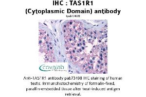 Image no. 1 for anti-Taste Receptor, Type 1, Member 1 (TAS1R1) (3rd Cytoplasmic Domain) antibody (ABIN1739914)