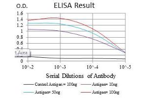 Black line: Control Antigen (100 ng), Purple line: Antigen(10 ng), Blue line: Antigen (50 ng), Red line: Antigen (100 ng), (SOX9 Antikörper)